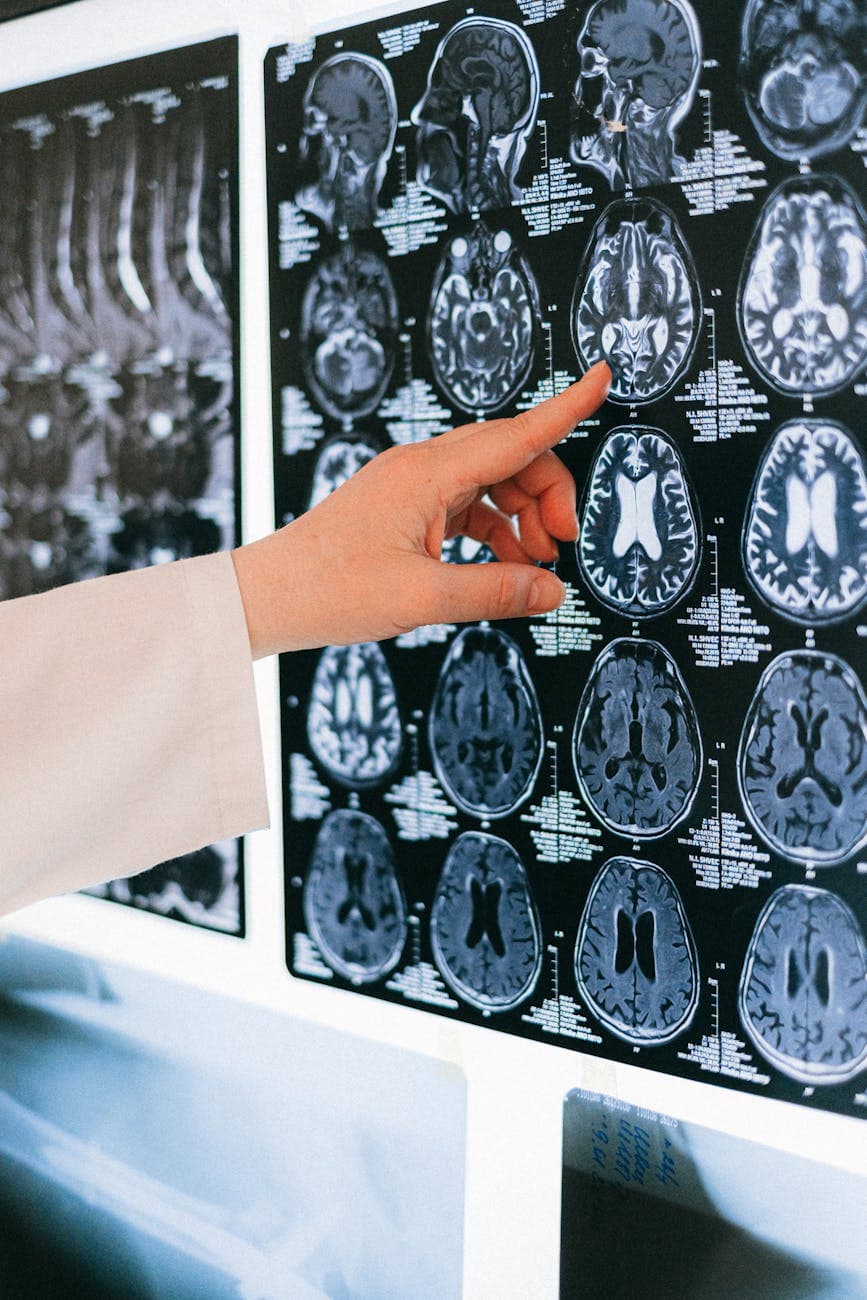 Radiologist examining brain MRI scans